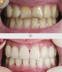http://m.bstoo.cn/d/file/price/0900567820.jpg