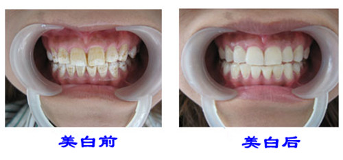 http://m.bstoo.cn/d/file/price/0957048116.jpg