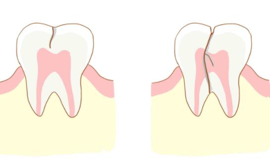 http://m.bstoo.cn/d/file/price/0m9zpeb47xnb.jpg
