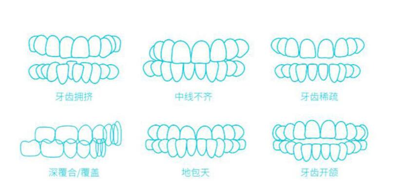 http://m.bstoo.cn/d/file/price/0p8xa8cbe5po.jpg