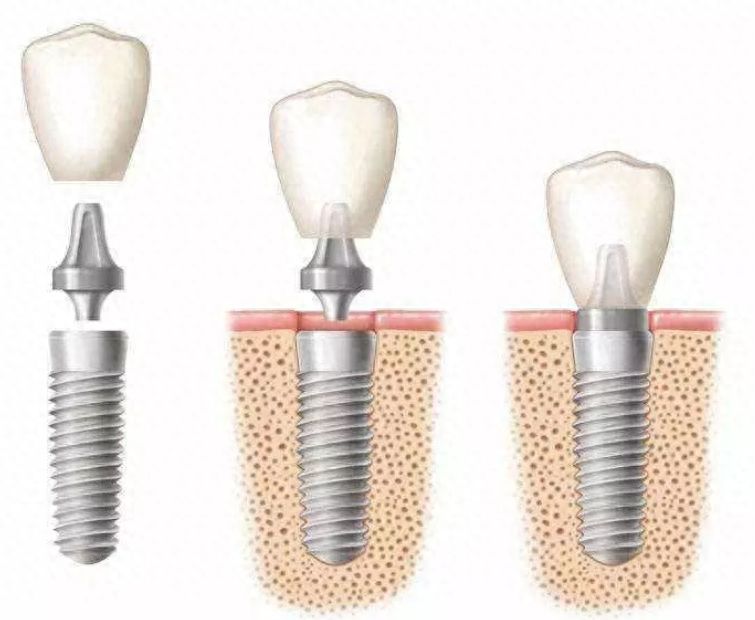http://m.bstoo.cn/d/file/price/12mg6sl403pu.jpg