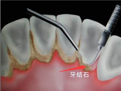 http://m.bstoo.cn/d/file/price/1339145197.jpg