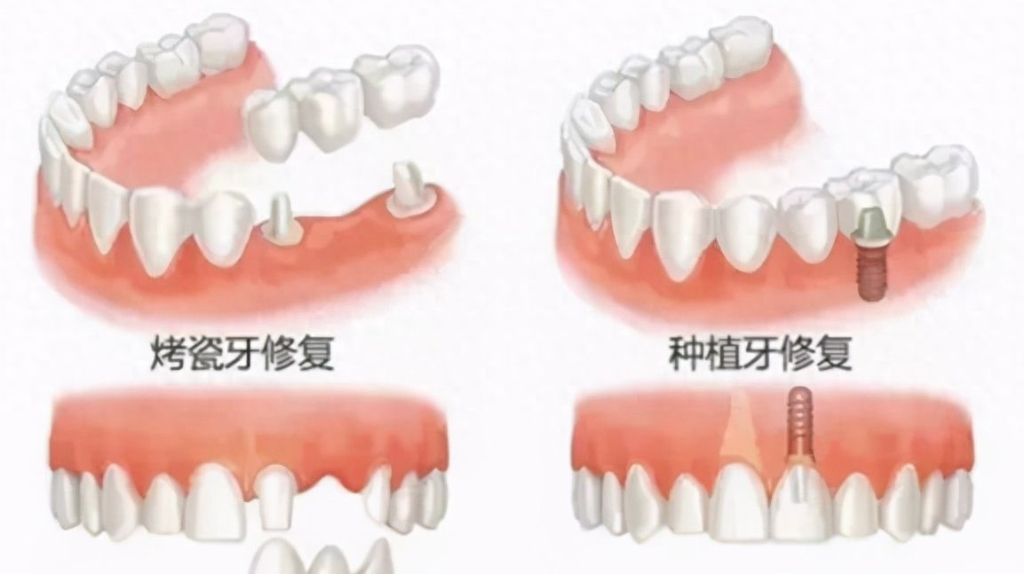 http://m.bstoo.cn/d/file/price/196v5ak98c.jpg