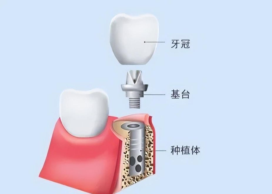 http://m.bstoo.cn/d/file/price/28omksizedqr.jpg