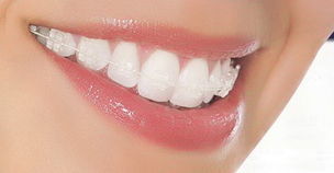 http://m.bstoo.cn/d/file/price/2HCELQ5CE7.jpg