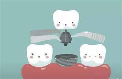 http://m.bstoo.cn/d/file/price/2ONPJL7CNK.jpg