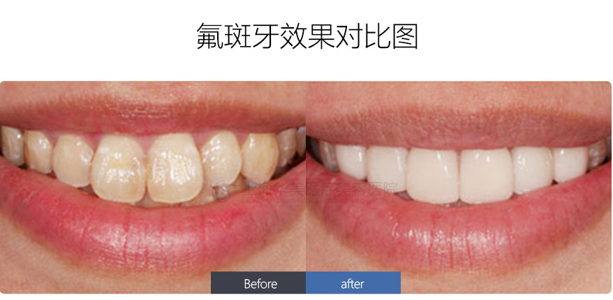 http://m.bstoo.cn/d/file/price/2SNFYPASP2.jpg