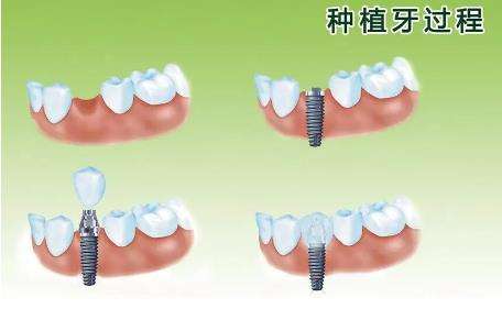 http://m.bstoo.cn/d/file/price/2c74zh2oid8g.jpg