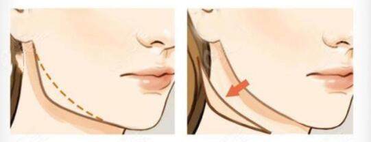http://m.bstoo.cn/d/file/price/310tbn1jqyxi.jpg