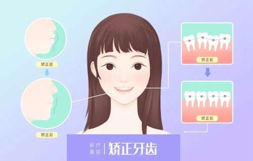 汕頭第二人民醫(yī)院口腔科口碑評價及牙齒正畸價格表