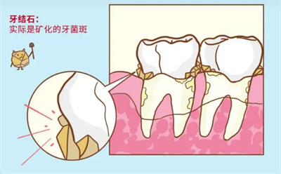 http://m.bstoo.cn/d/file/price/3E9NUHTK8G.jpg