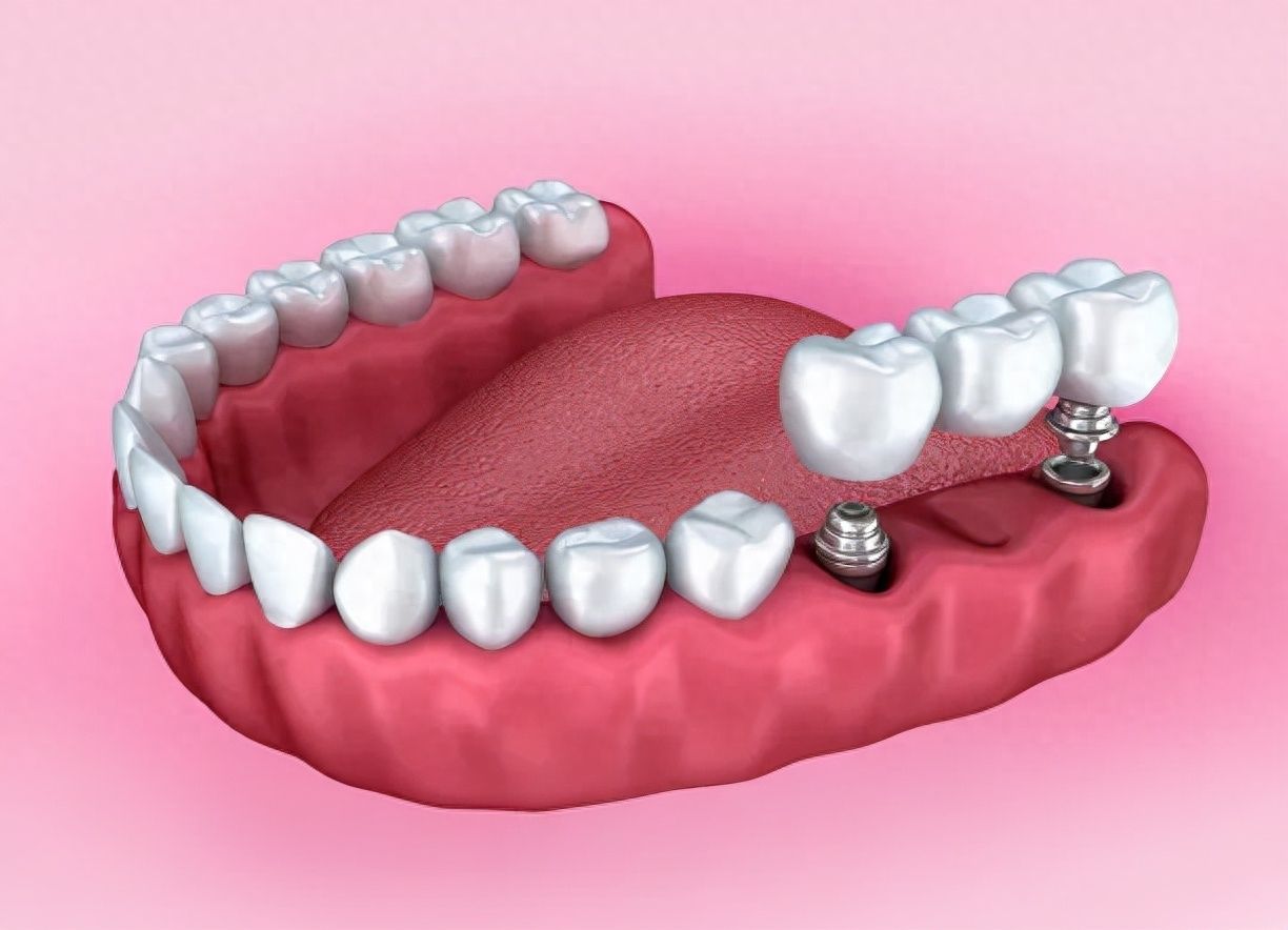 http://m.bstoo.cn/d/file/price/3gtq6dmtjs2w.jpg