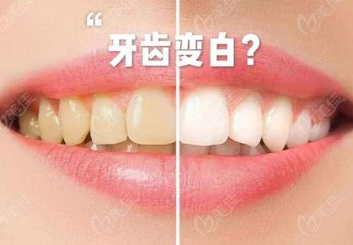 http://m.bstoo.cn/d/file/price/44t6a2fih7.jpg
