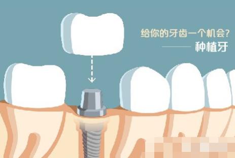 http://m.bstoo.cn/d/file/price/493apc3w6s4d.jpg
