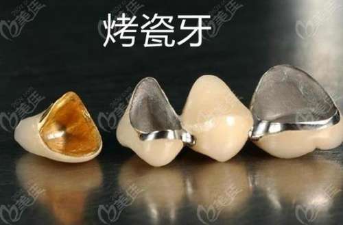 http://m.bstoo.cn/d/file/price/4tuwkzkh69h0.jpg
