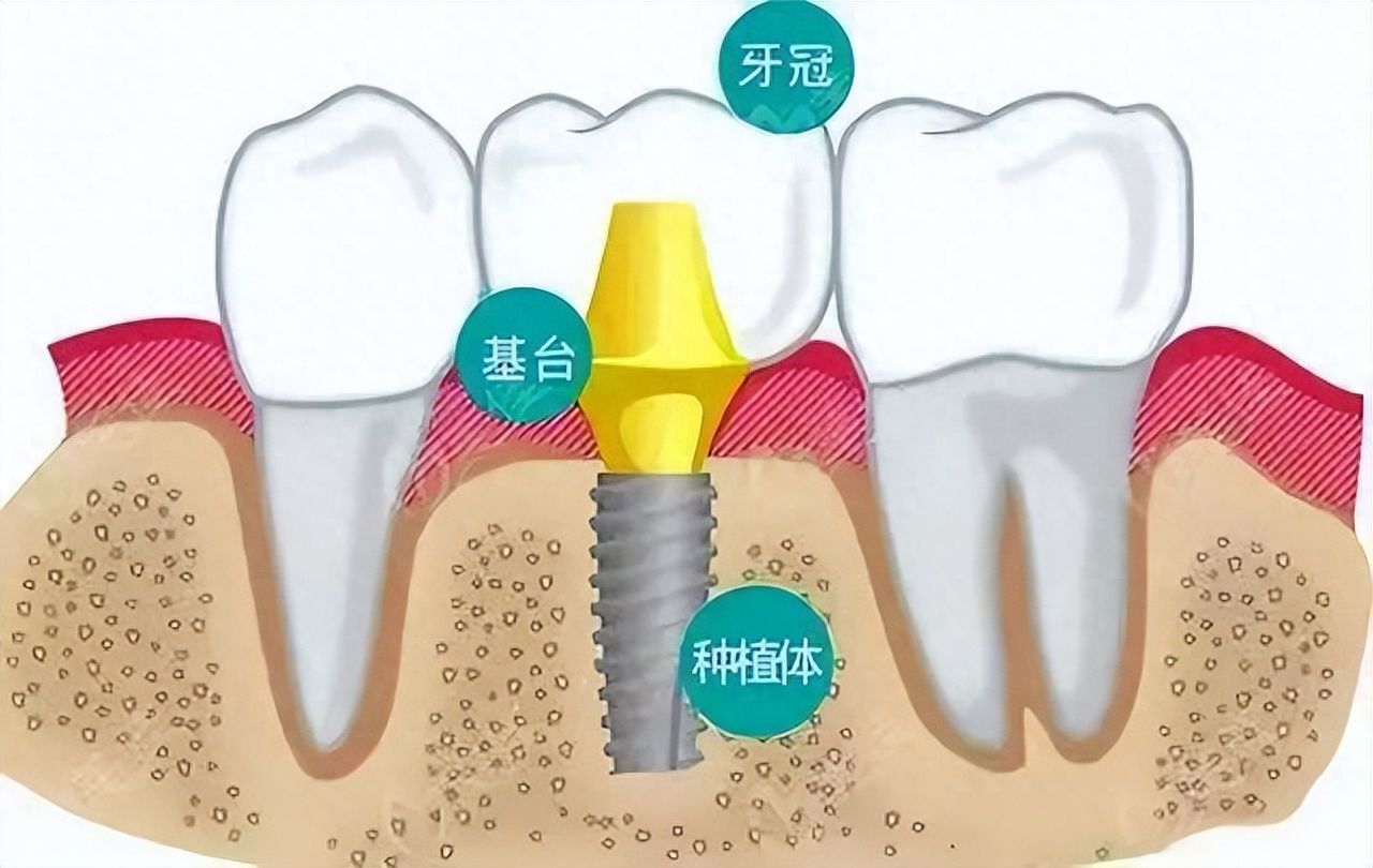 http://m.bstoo.cn/d/file/price/5t8nai1au2.jpg