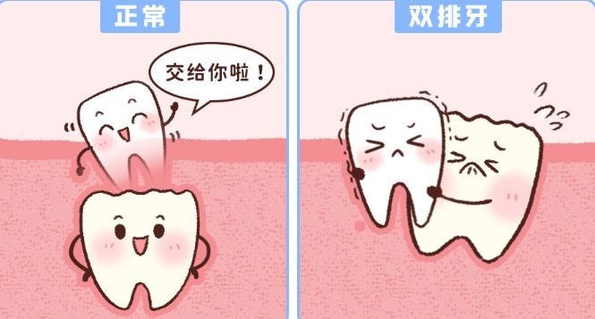 蚌埠三院牙齒矯正費用全揭秘：透明標(biāo)價，品質(zhì)服務(wù)