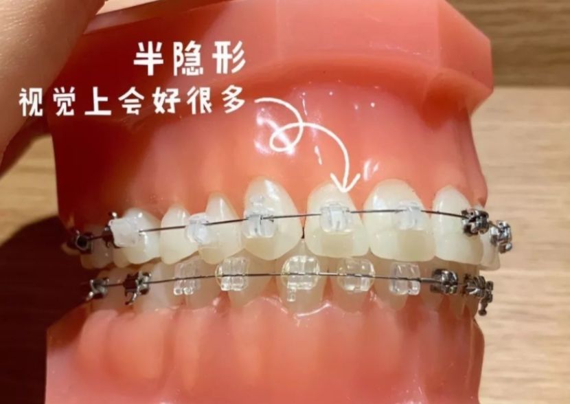 http://m.bstoo.cn/d/file/price/6fl7es2blbjk.jpg