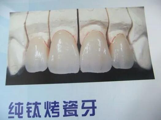 http://m.bstoo.cn/d/file/price/6rh9r49b0nko.jpg