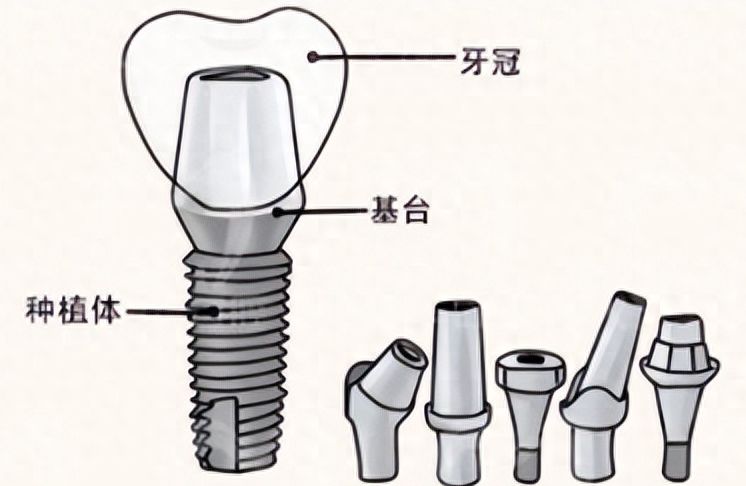 http://m.bstoo.cn/d/file/price/7trmumsttcgn.jpg