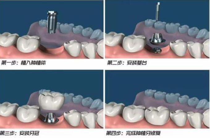 http://m.bstoo.cn/d/file/price/8dks998fly45.jpg