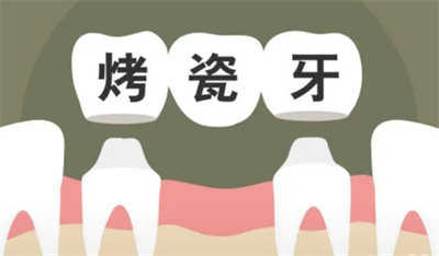 http://m.bstoo.cn/d/file/price/8j5b1s85vj0w.jpg