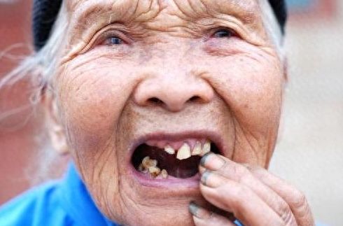 優(yōu)伢仕口腔醫(yī)院收費(fèi)指南：2024最新價(jià)格表