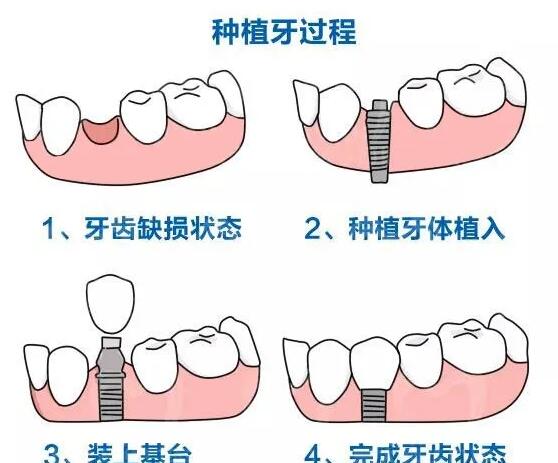 http://m.bstoo.cn/d/file/price/AOS55SBEP7.jpg