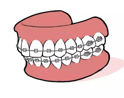 http://m.bstoo.cn/d/file/price/CPL62SR2S5.jpg