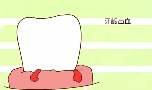 http://m.bstoo.cn/d/file/price/K5348LKGA7.jpg