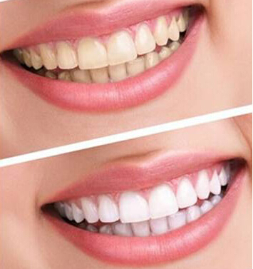 http://m.bstoo.cn/d/file/price/MGA855IR0H.jpg
