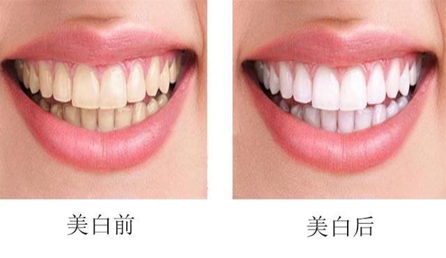 http://m.bstoo.cn/d/file/price/VXXHD6Y7XI.jpg