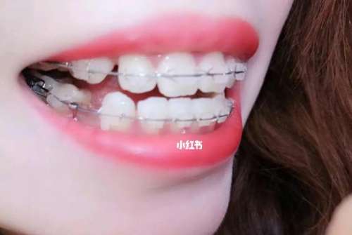 http://m.bstoo.cn/d/file/price/a3ht1v4ddlkt.jpg