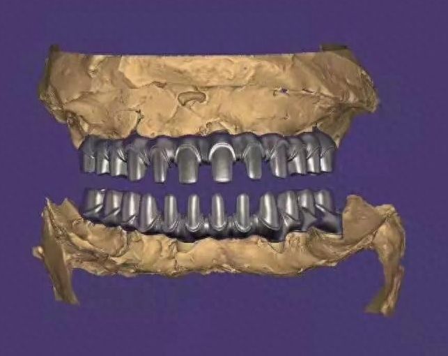 http://m.bstoo.cn/d/file/price/ajw0re0canbi.jpg