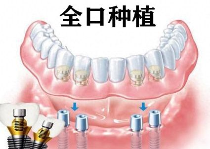 http://m.bstoo.cn/d/file/price/awbmy58tgw4b.jpg