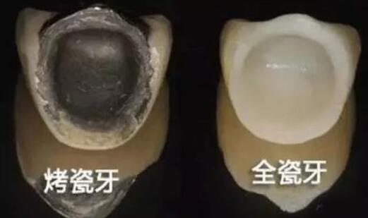 http://m.bstoo.cn/d/file/price/bd3x8ql2zqx8.jpg