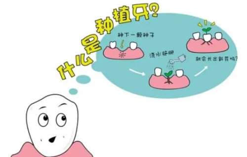 義烏全瓷牙種植價(jià)格清單