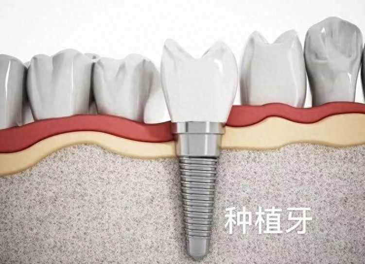 http://m.bstoo.cn/d/file/price/bv4j1vxlfbf3.jpg