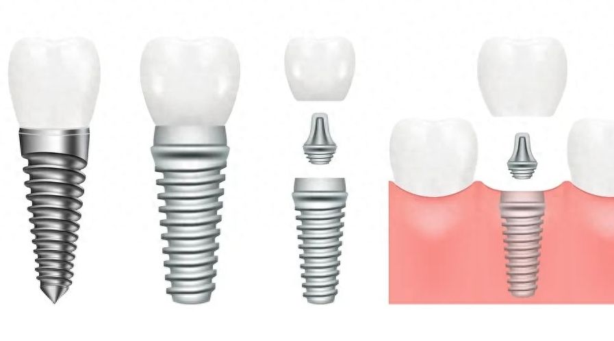 http://m.bstoo.cn/d/file/price/bwbf40hho1q3.jpg