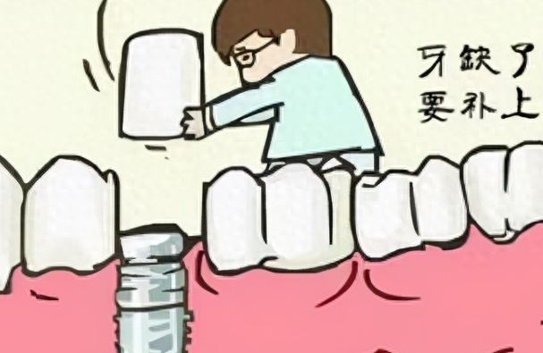 2024種植牙醫(yī)院推薦：精選全國5家公立?？漆t(yī)院+價格表