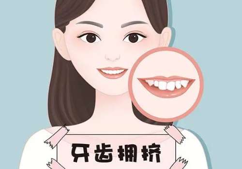http://m.bstoo.cn/d/file/price/c67cg2m408l4.jpg