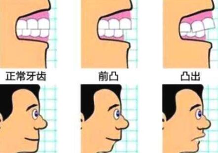 http://m.bstoo.cn/d/file/price/ducm5xbtmnfl.jpg