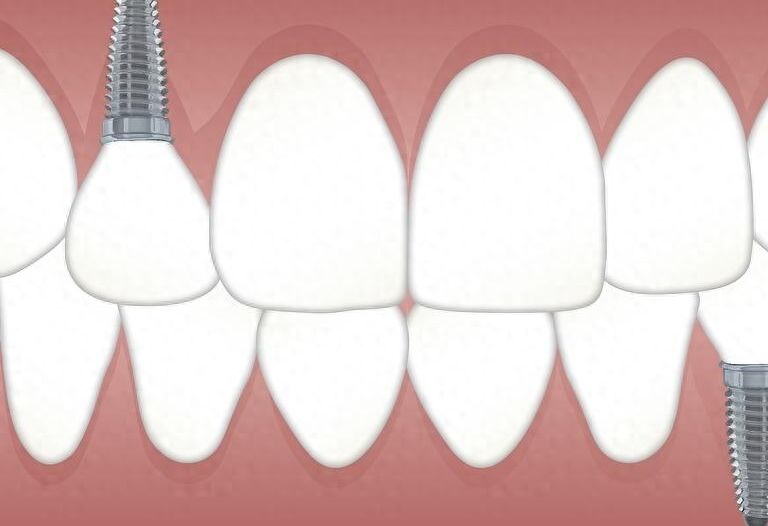 http://m.bstoo.cn/d/file/price/eapbjbjuv8.jpg