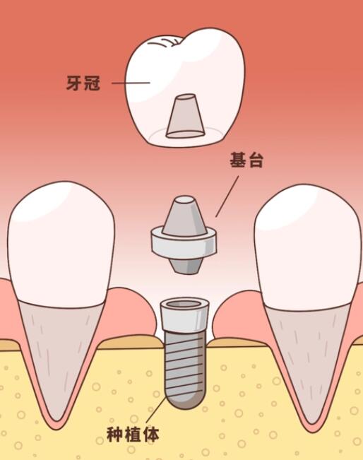 http://m.bstoo.cn/d/file/price/ee01ptvi5ib3.jpg
