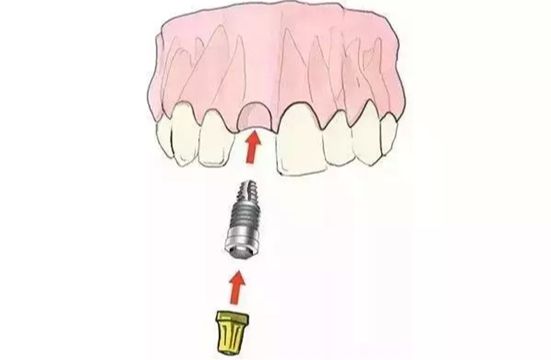 http://m.bstoo.cn/d/file/price/eh913tjdp7ig.jpg