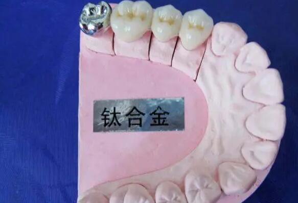 http://m.bstoo.cn/d/file/price/es847ov18yp4.jpg