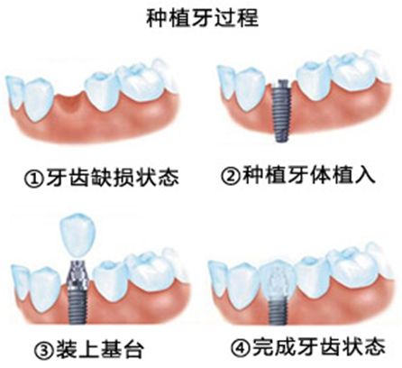 長(zhǎng)沙牙大夫口腔醫(yī)院實(shí)力大起底：口碑、特色、價(jià)格指南