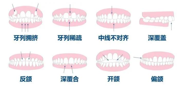 http://m.bstoo.cn/d/file/price/fxixkh7zgi.jpg