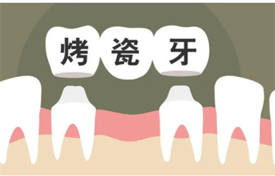 http://m.bstoo.cn/d/file/price/fyu8mfcx2qb9.jpg