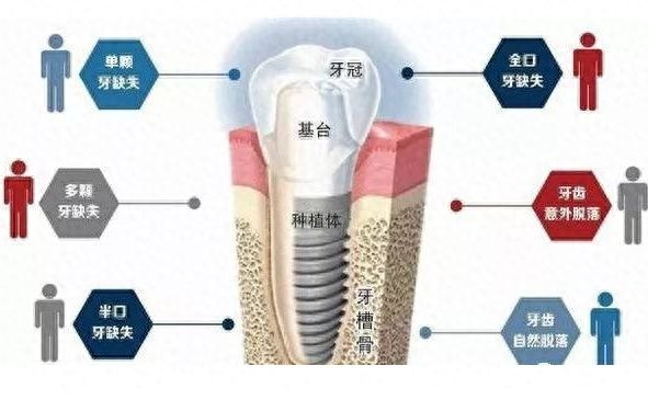 http://m.bstoo.cn/d/file/price/g3pwir3wjlbi.jpg